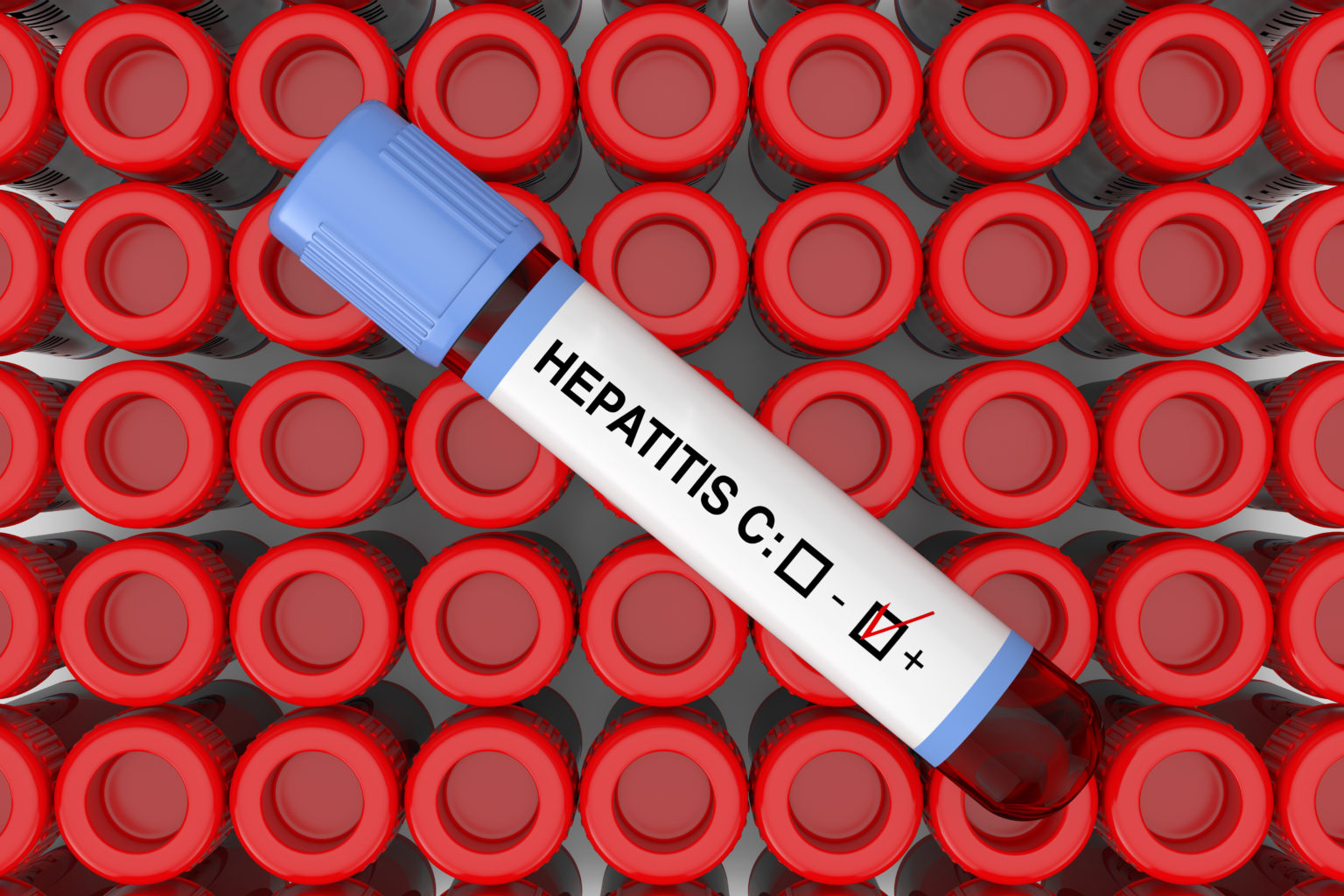 Here's How Your Hepatitis Plasma Donation Plays A Key Role In Saving ...